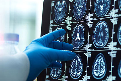 Traumatic Brain Injuries